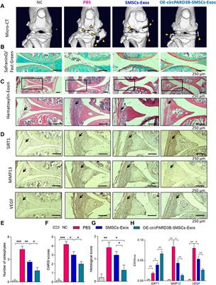 Potential predictive and therapeutic applications of small extracellular vesicles-derived circPARD3B in osteoarthritis